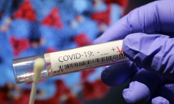 57-годишен е приет с коронавирус в Горна Оряховица
